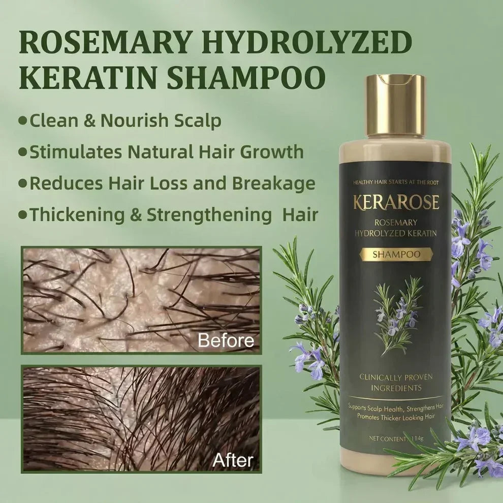 ✨ Kerarose Rosemary + Keratin Shampoo 🌿 | Salon-Like Strong & Voluminous Hair 💁‍♀️ | BUY 1 GET 1 FREE