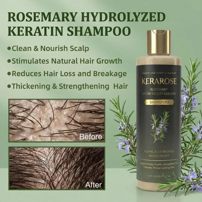 ✨ Kerarose Rosemary + Keratin Shampoo 🌿 | Salon-Like Strong & Voluminous Hair 💁‍♀️ | BUY 1 GET 1 FREE