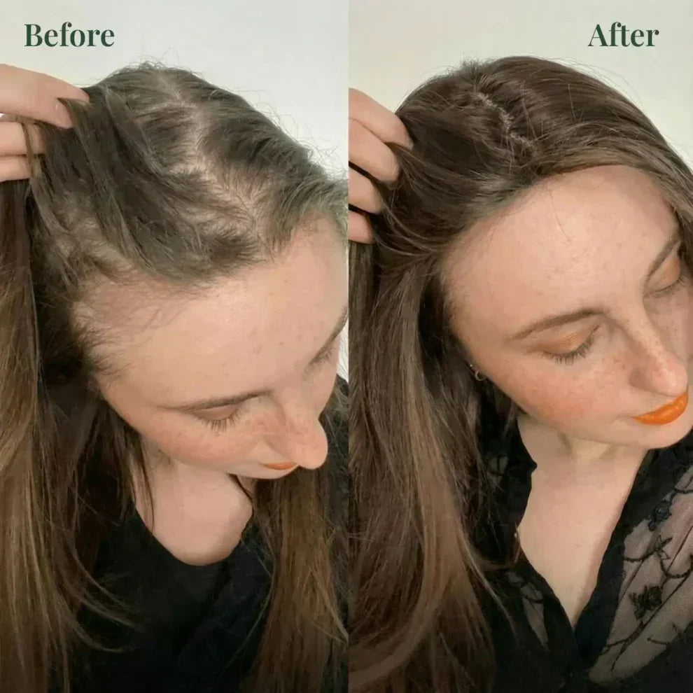 ✨ Kerarose Rosemary + Keratin Shampoo 🌿 | Salon-Like Strong & Voluminous Hair 💁‍♀️ | BUY 1 GET 1 FREE
